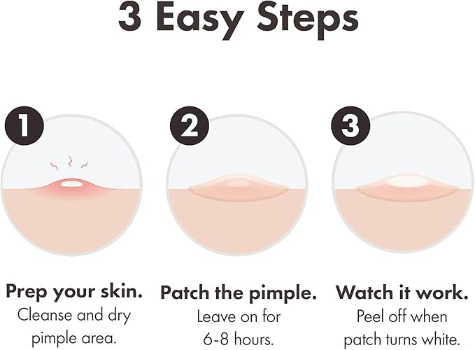 Mighty Patch Original Spot Patches by Hero Cosmetics, Day & Night Time Acne Treatment, Clear Spot Remover Hydrocolloid Patches, Anti Acne Dots, Spot Treatment Pimple Stickers - 36 Patches